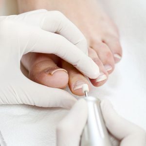 pedicure1